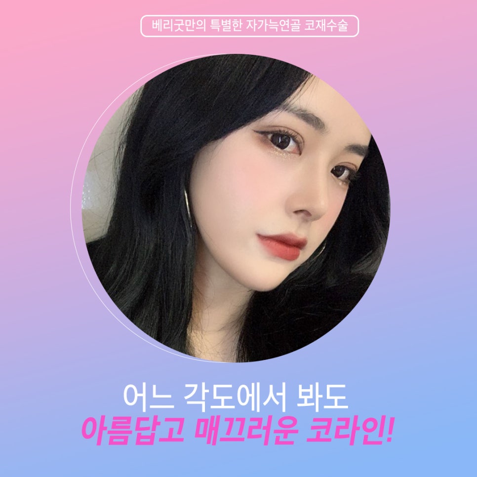 자가늑연골 코성형의 모든것 (코재수술 2탄!) 관련 이미지 3