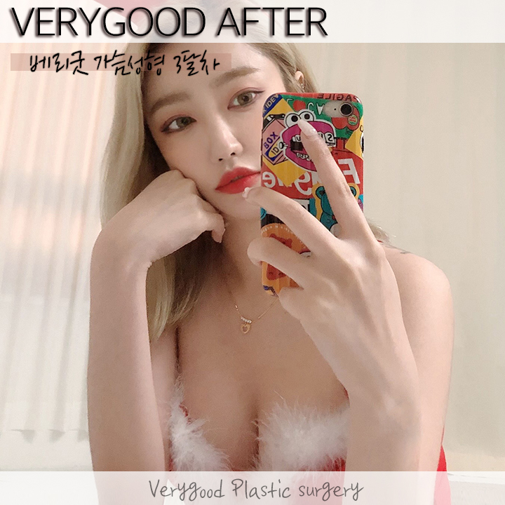 베리굿 가슴성형💖세빈 마이크로 텍스쳐💖 관련 이미지 9