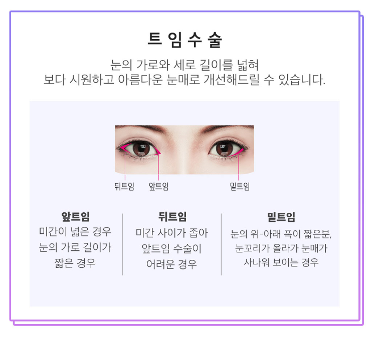 쌍꺼풀수술 비용부터 수술방법까지 관련 이미지 9