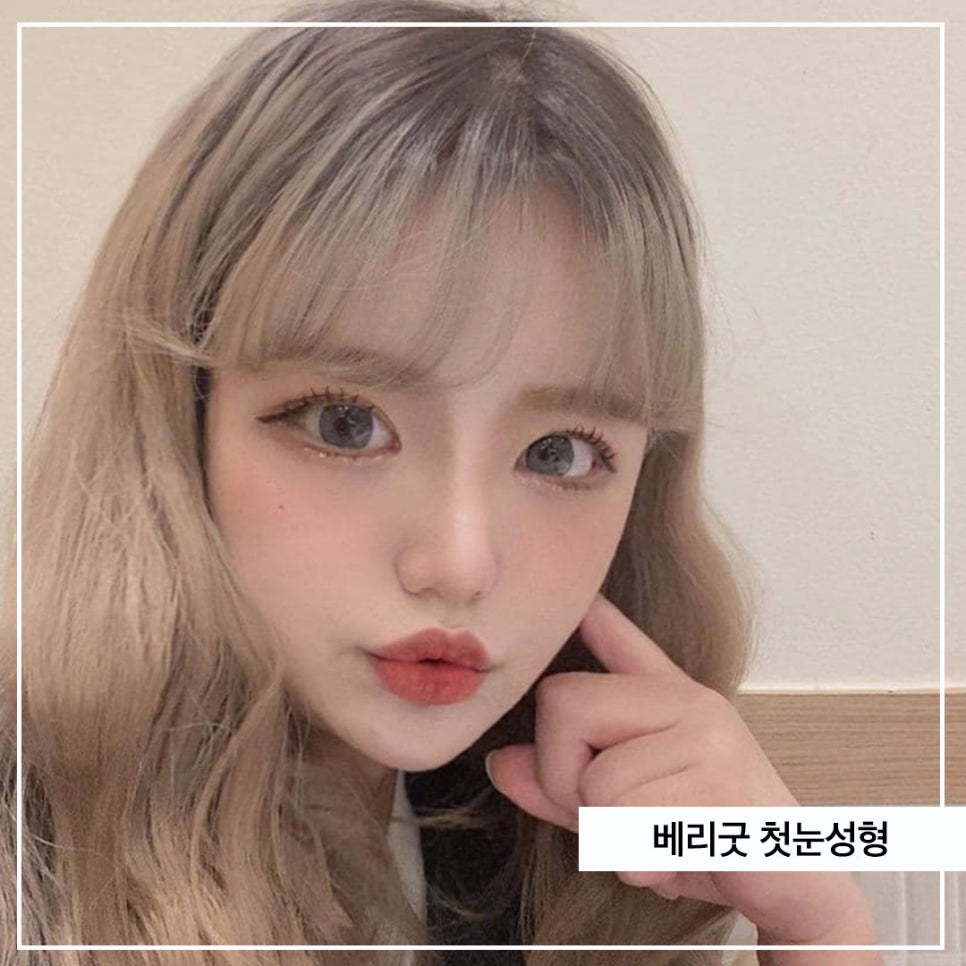 아름다운 당신을 위한 베리굿의 첫눈성형 관련 이미지 1