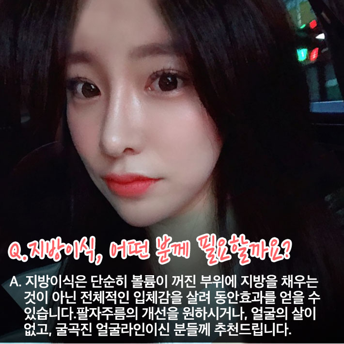 지방이식의 모든것이 궁금할때!! 베리굿이 알려줄게! 관련 이미지 3