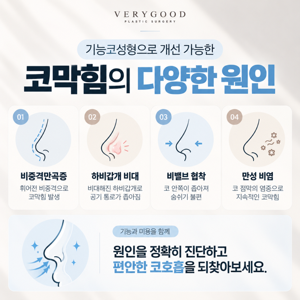 코로 숨을 들이마실 때 답답하다면? 비밸브 협착과 기능코성형 관련 이미지 3