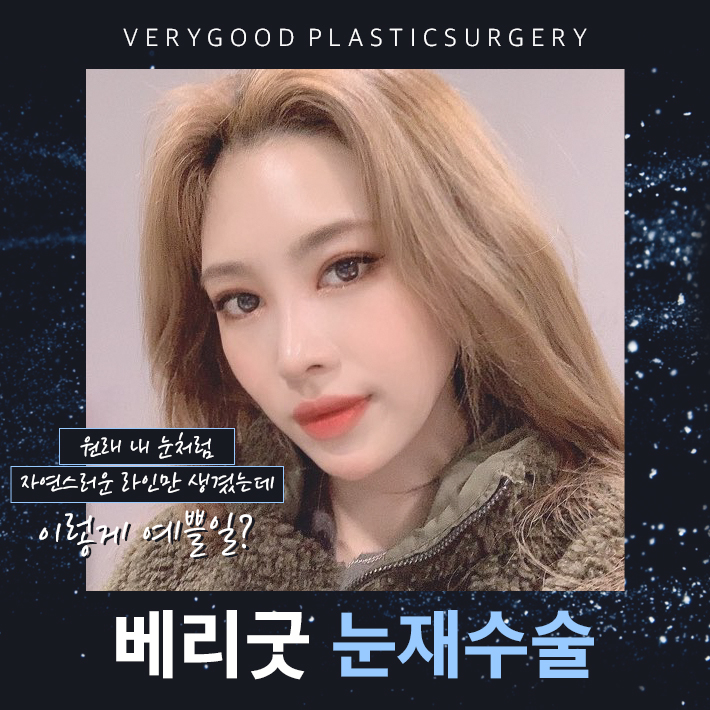 눈재수술 알맞는 수술법으로 만족스럽게 관련 이미지 1