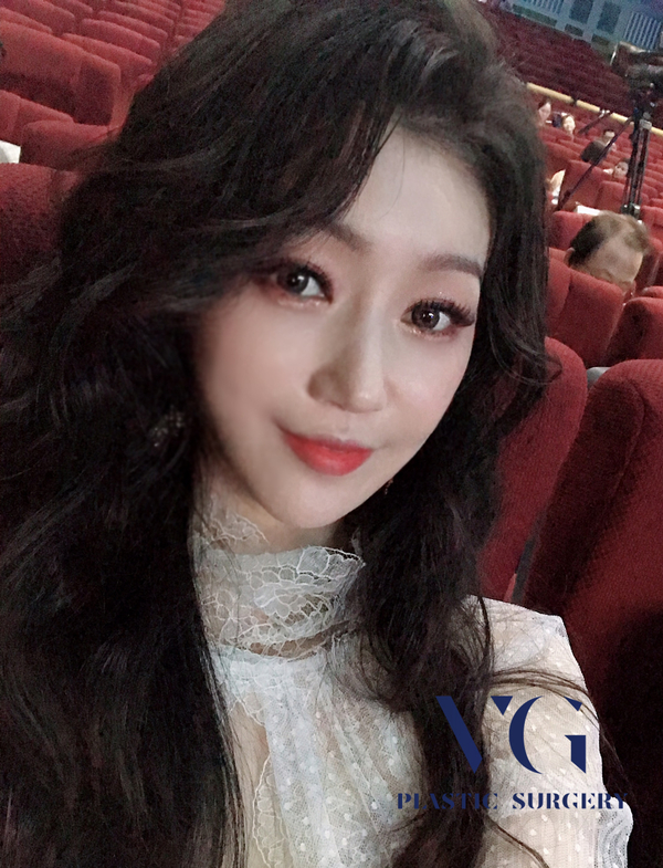 PRP지방이식으로 생착률 UP! 생기 UP! 관련 이미지 1