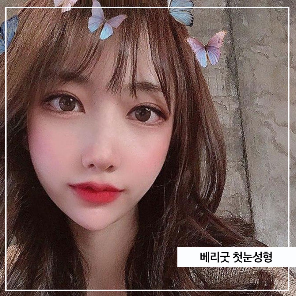 쌍꺼플고민 <베리굿>에서 해결하세용!!! 관련 이미지 1