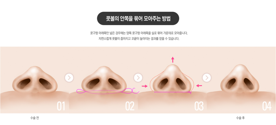 세련된 이미지를 원하신다면? 지금 바로 베리굿성형외과로! 관련 이미지 5