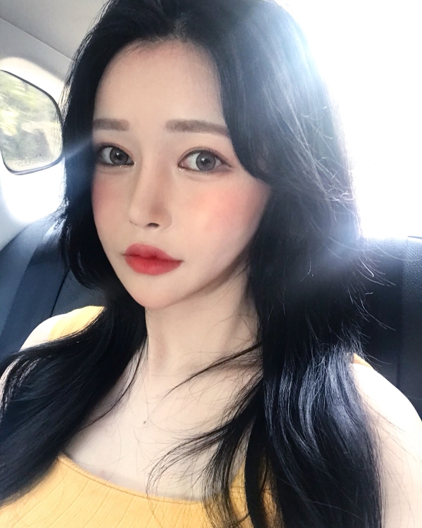 눈성형잘하는곳 잘고르는법 관련 이미지 8