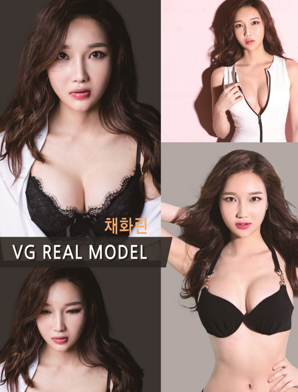 가슴수술은 베리굿성형외과 관련 이미지 1