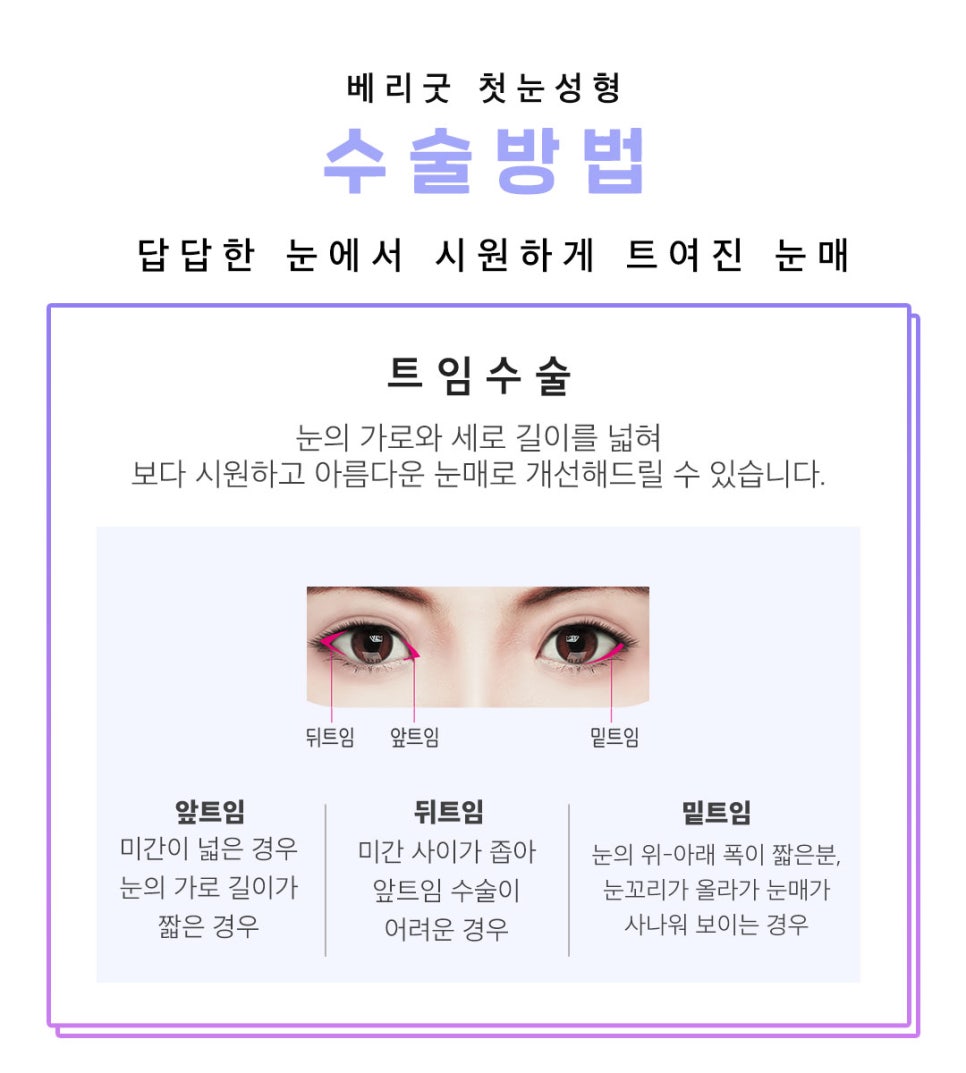 아름다운 당신을 위한 베리굿의 첫눈성형 관련 이미지 5