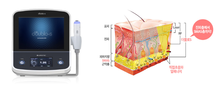 더블로 골드 리프팅으로 나이는 낮추고 탄력은 높이자! 관련 이미지 4