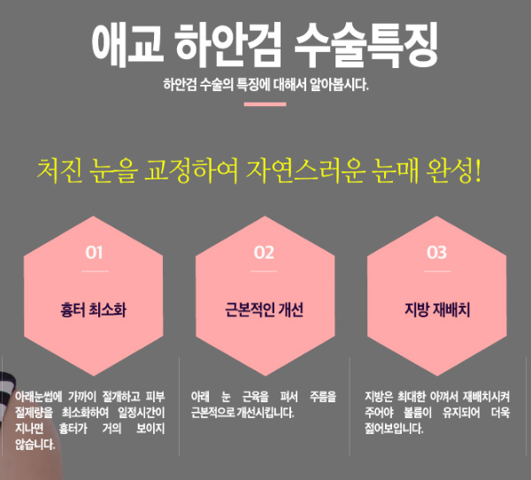 눈가주름없애는법 눈밑주름없애는법 눈밑지방재배치 하안검수술 차이점 관련 이미지 6