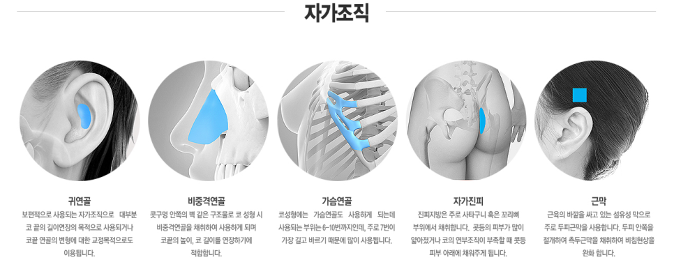 낮은 콧대 모여라❣❣ 베리굿 코끝성형으로 예뻐지자✨ 관련 이미지 5