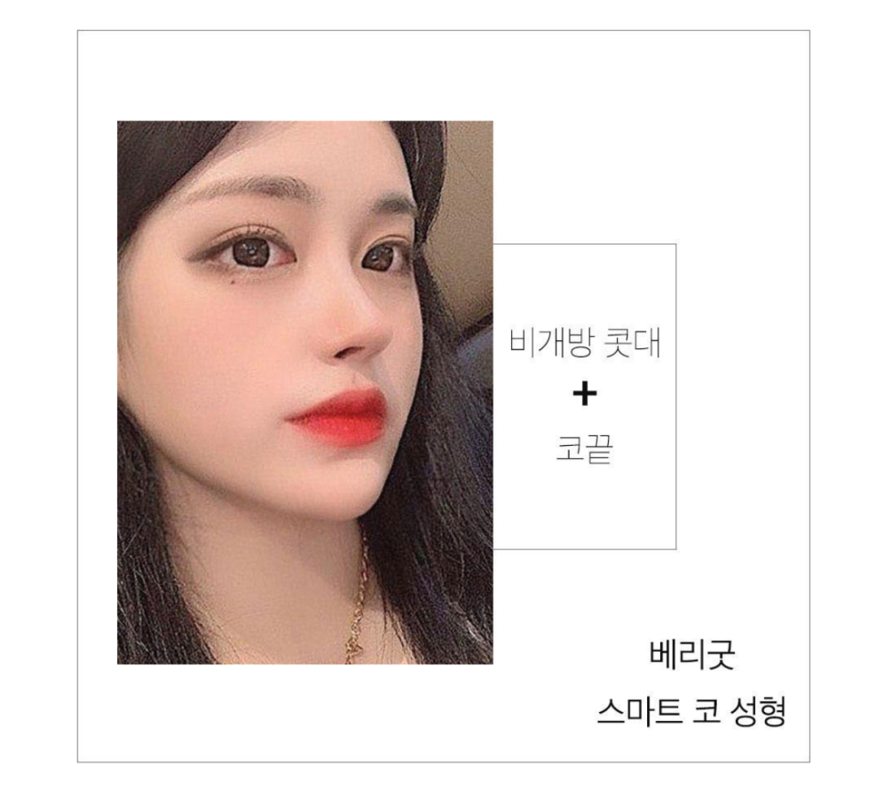 이제 코성형도 스마트하게✨ 베리굿 비개방코성형💖 관련 이미지 3