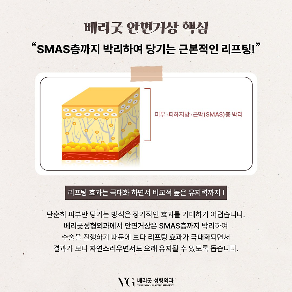 동안 얼굴과 처짐개선 동시에 원한다면 , 베리굿성형외과 안면거상 관련 이미지 3