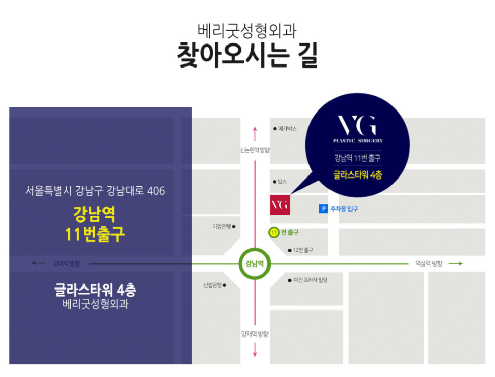 눈재수술 전문, 베리굿성형외과 임영민 원장님 관련 이미지 14