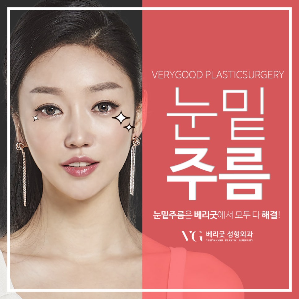 화사하고 동안 눈밑을 만들어주는 애교하안검 관련 이미지 1