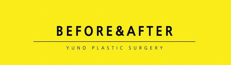 얼굴 작아지는법/ 베리굿성외과 3D광대축소술180만원 /강남역성형외과/강남역위치 관련 이미지 10