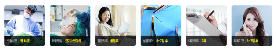 베리굿성형외과 중년 눈성형 (상안검), 그때 그 시절 나의 리즈로 #베리굿성형외과 #임영민원장님 관련 이미지 4