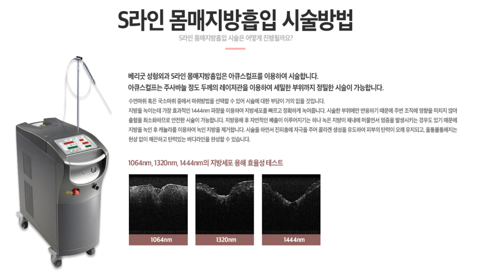 베리굿 몸매💖베리굿 허벅지 지방흡입 전후👙 관련 이미지 6