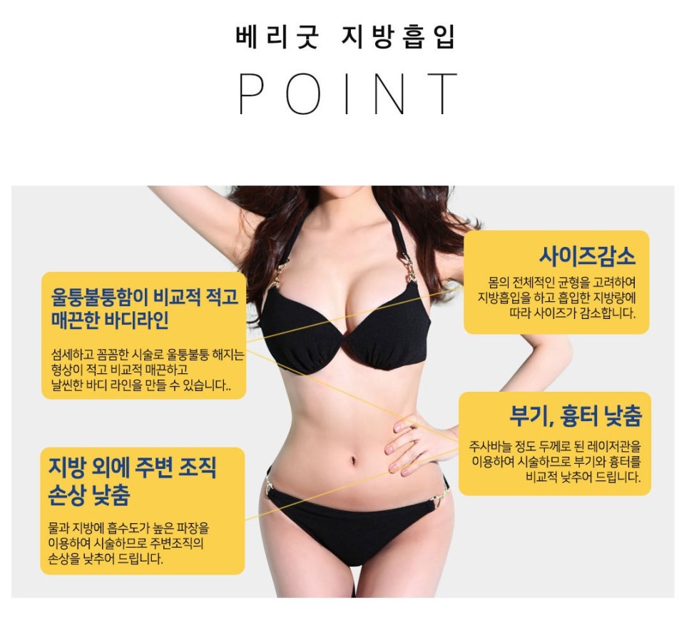 지방흡입도 베리굿하게❤ 관련 이미지 2