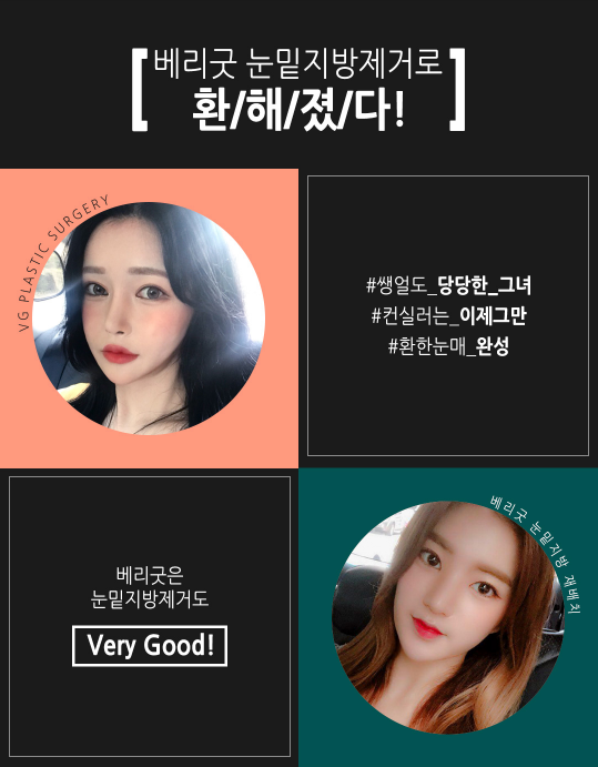 눈밑지방제거로 눈밑은 매끈하고 환하게! 관련 이미지 4