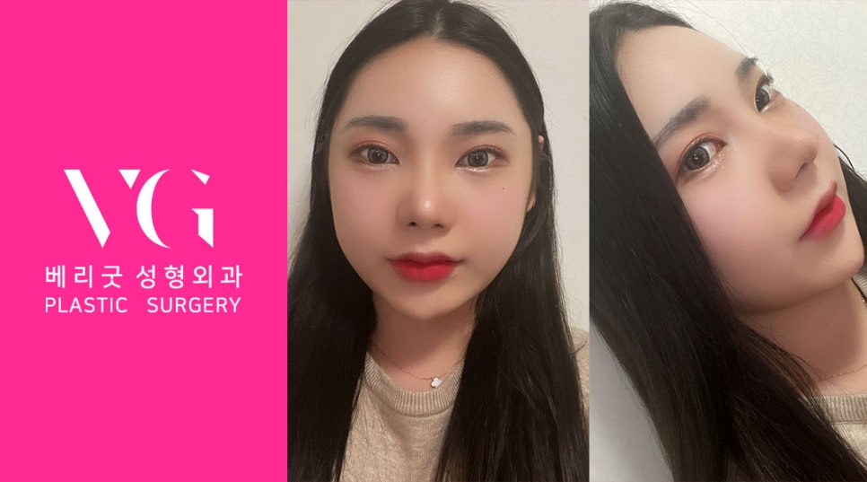 베리굿 안면윤곽💖어디서 봐도 VERY GOOD✨ 관련 이미지 3