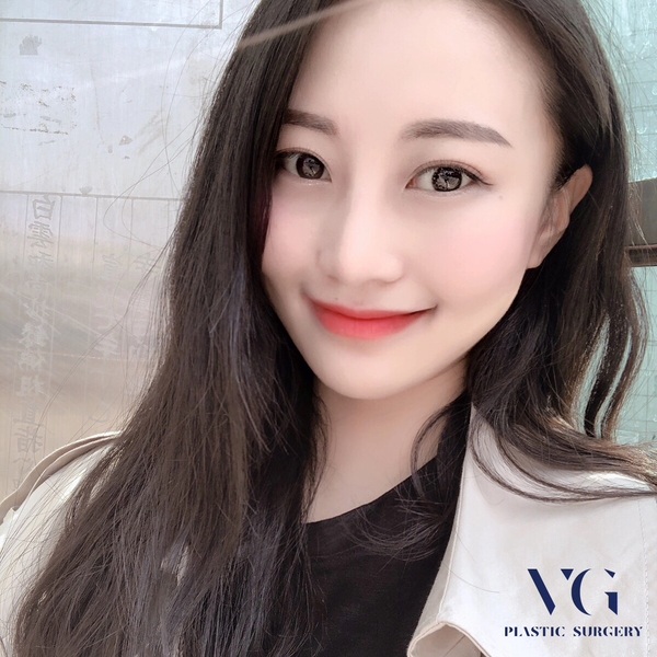 눈밑지방재배치 하고 환한 쌩얼로 자신있게! 관련 이미지 6