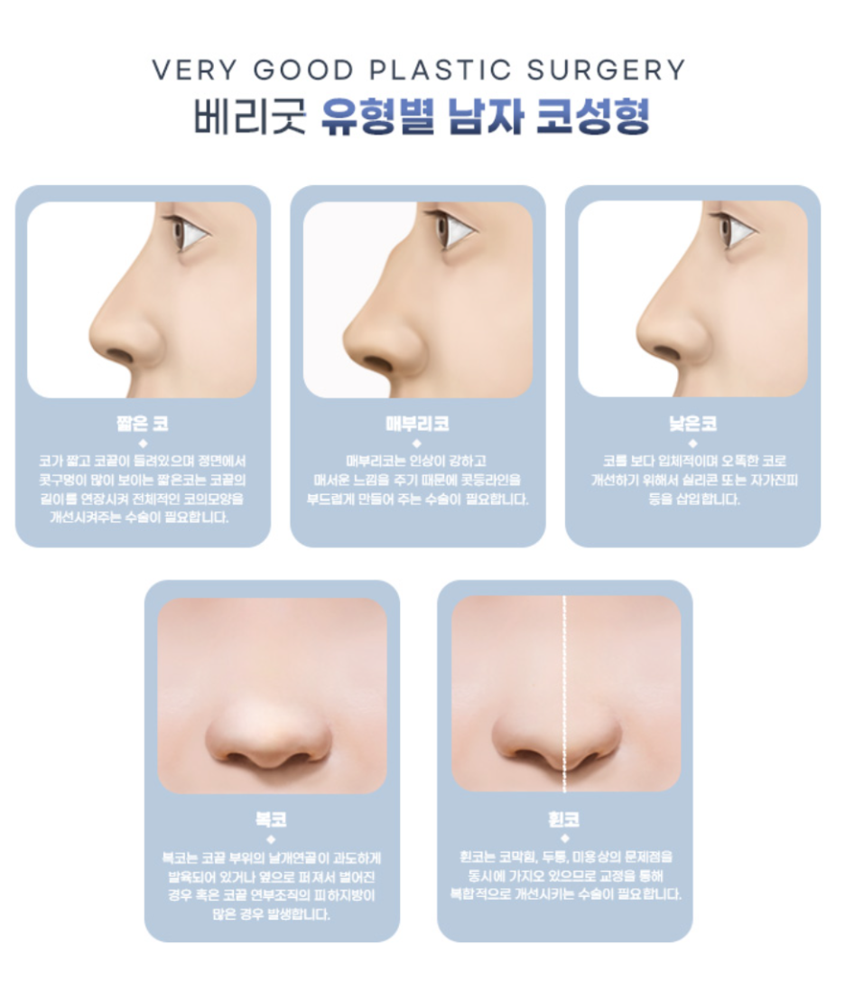 남자다운 직선 코라인으로 깔끔한 인상 완성, 강남역 베리굿성형외과 남자코성형 관련 이미지 4