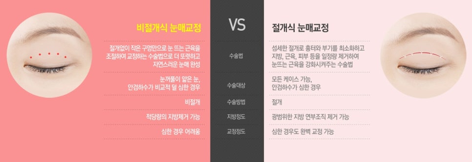 [베리굿성형외과 강남눈매교정]누구나 반하는 또렷한 눈매만들기✨ 관련 이미지 9