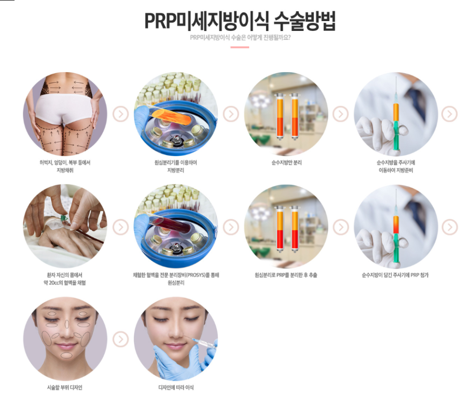 PRP지방이식으로 생착률 UP! 생기 UP! 관련 이미지 4