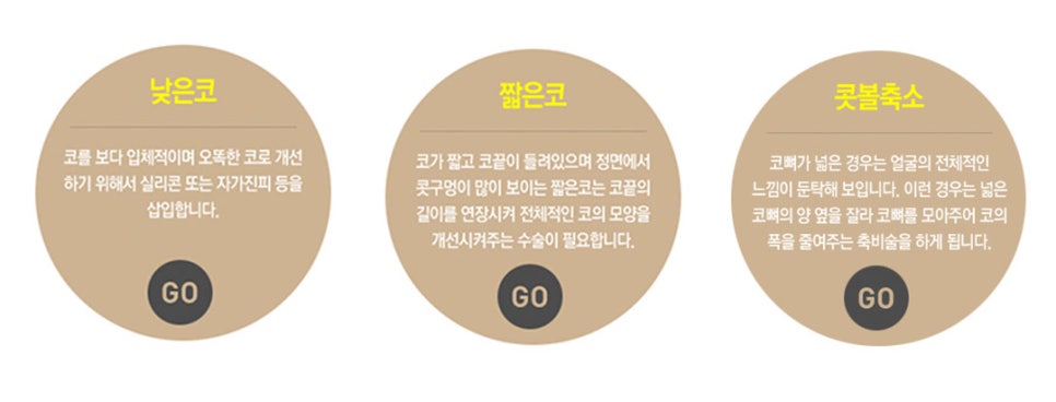 남자코성형은? 베리굿성형외과💙 관련 이미지 4