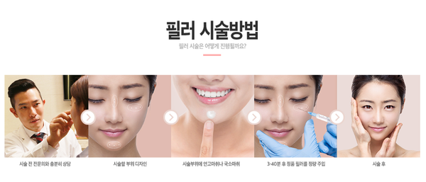 필러시술, 뭐가 중요할까? 관련 이미지 3