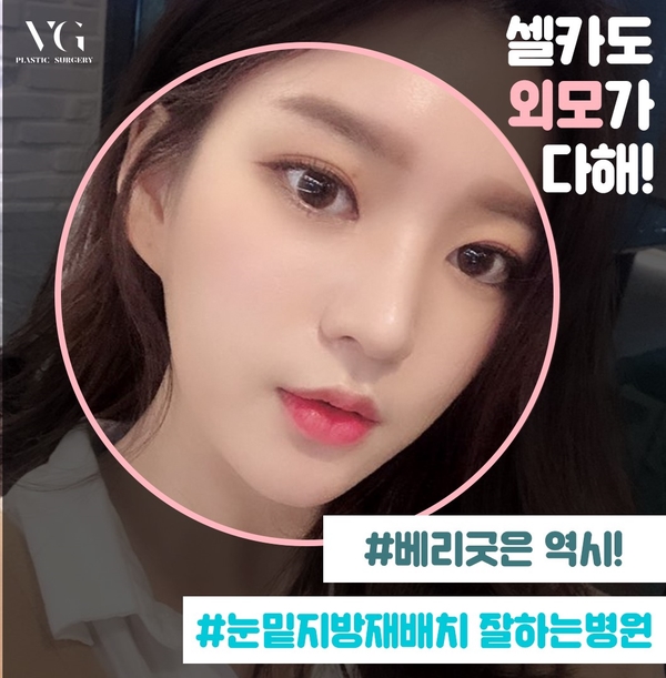 눈밑지방재배치 하고 환한 쌩얼로 자신있게! 관련 이미지 1