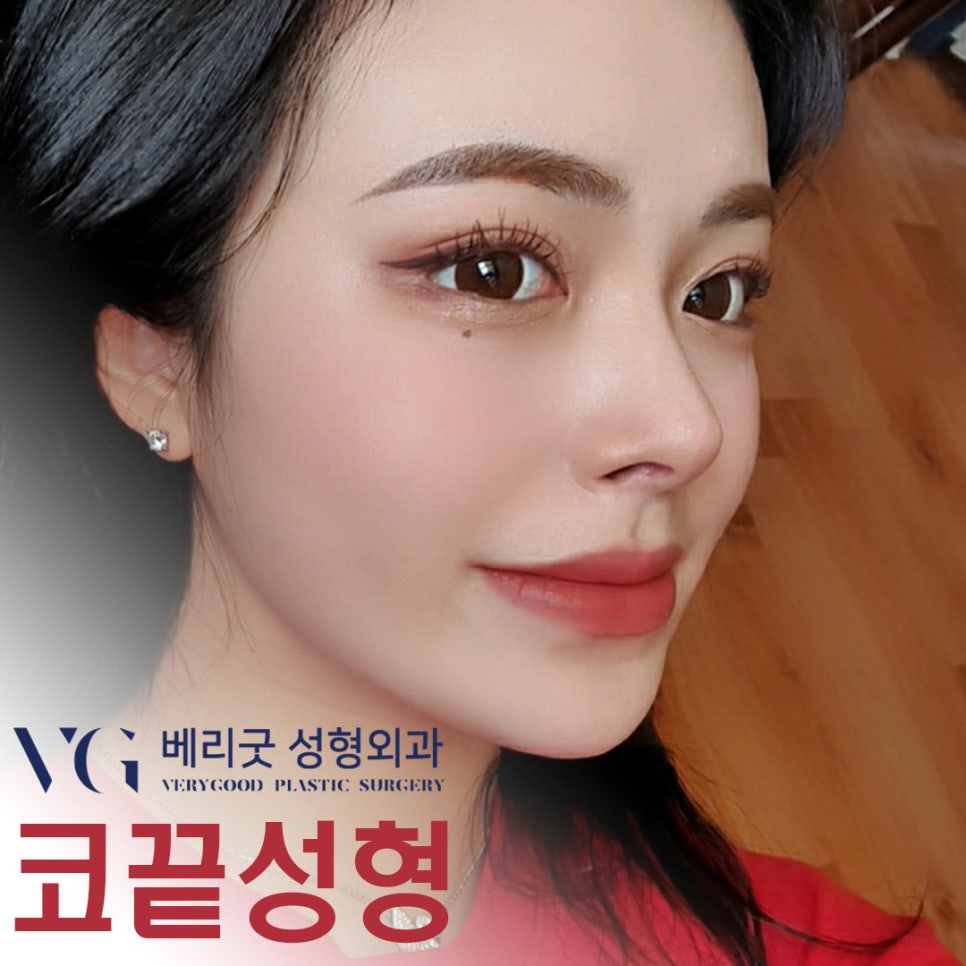 낮은 콧대 모여라❣❣ 베리굿 코끝성형으로 예뻐지자✨ 관련 이미지 1