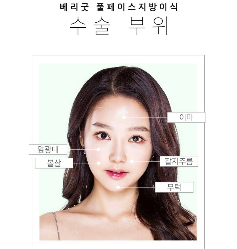 풀페이스 지방이식,지방이식 가격 알아보자 관련 이미지 4