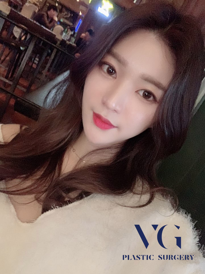 얼굴지방흡입 하고 포토샵이 필요없는 매끈한 얼굴라인 만들자! 관련 이미지 1