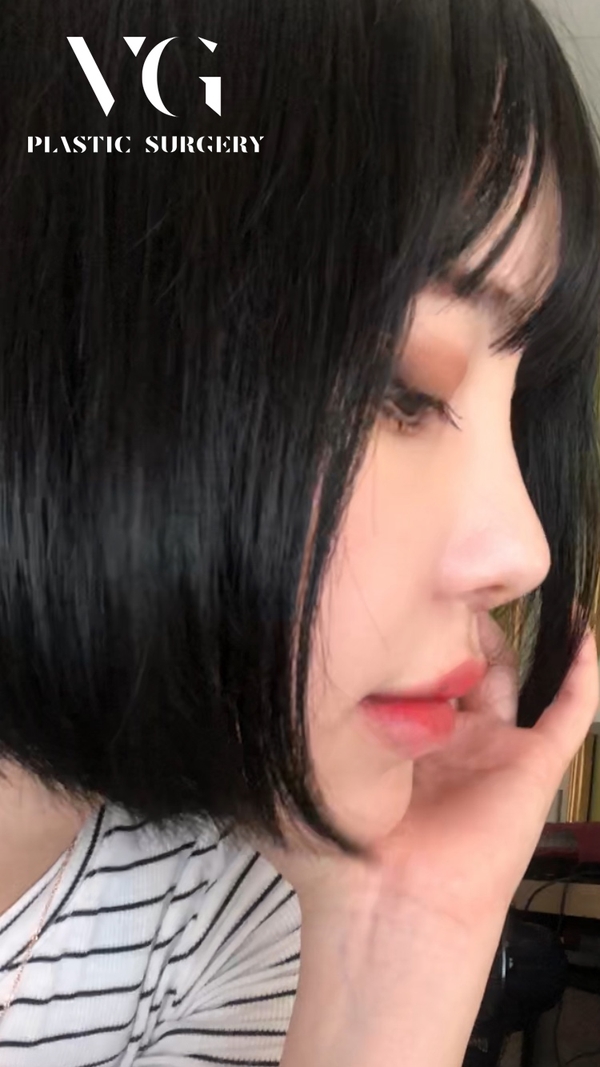 코성형 하나로 세련된 이미지완성! 관련 이미지 1