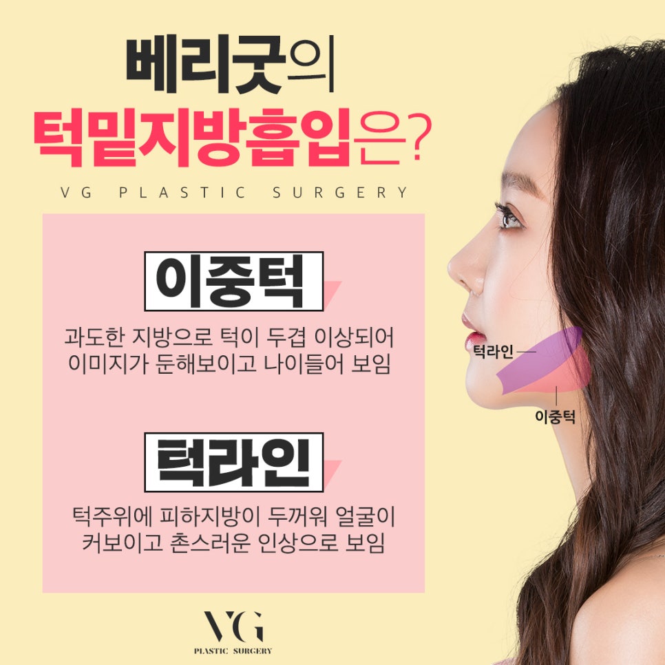 얼굴지방흡입, 후기 확인하고 성공적으로! 관련 이미지 4