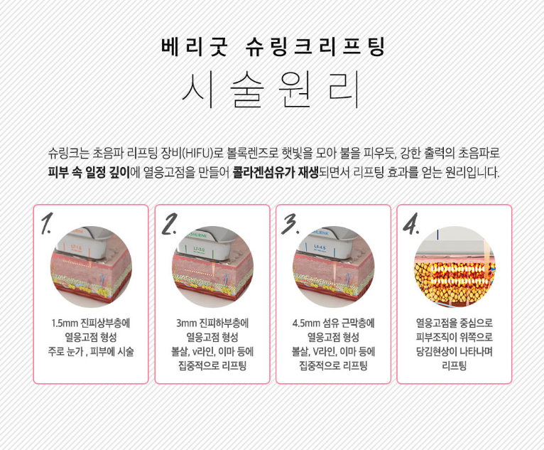 강남 슈링크 잘하는곳을 찾고있다면? (내돈내받 후기) 관련 이미지 6