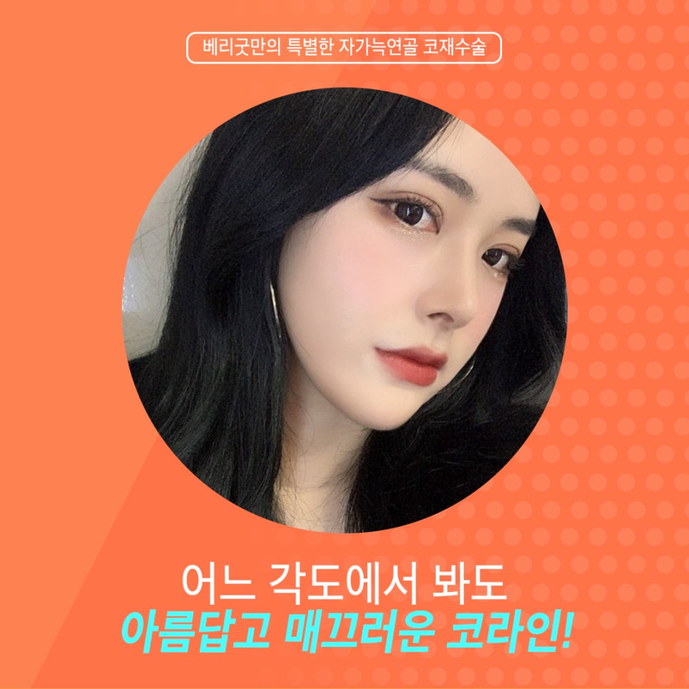 늑연골코재수술, 안전하고 아름답게! 관련 이미지 2