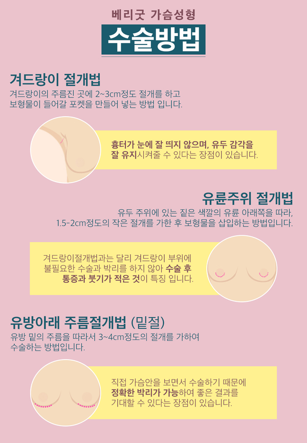부족한 볼륨, 베리굿 디자인하고 채워주자 관련 이미지 4