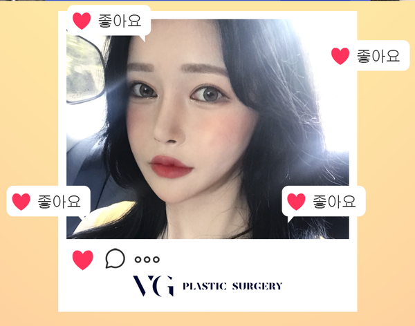 비절개눈매교정 또렷하고 선명한 인상으로! 관련 이미지 1