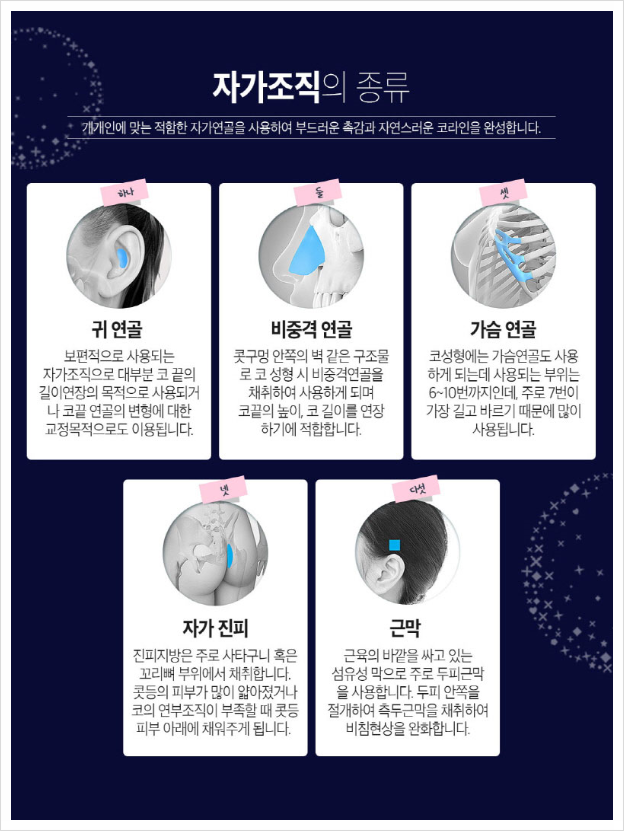 남자코성형! 뭐부터 알아봐야할까? 관련 이미지 8