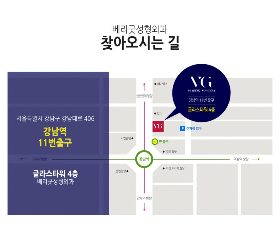 얼굴 작아지는법/ 베리굿성외과 3D광대축소술180만원 /강남역성형외과/강남역위치 관련 이미지 16