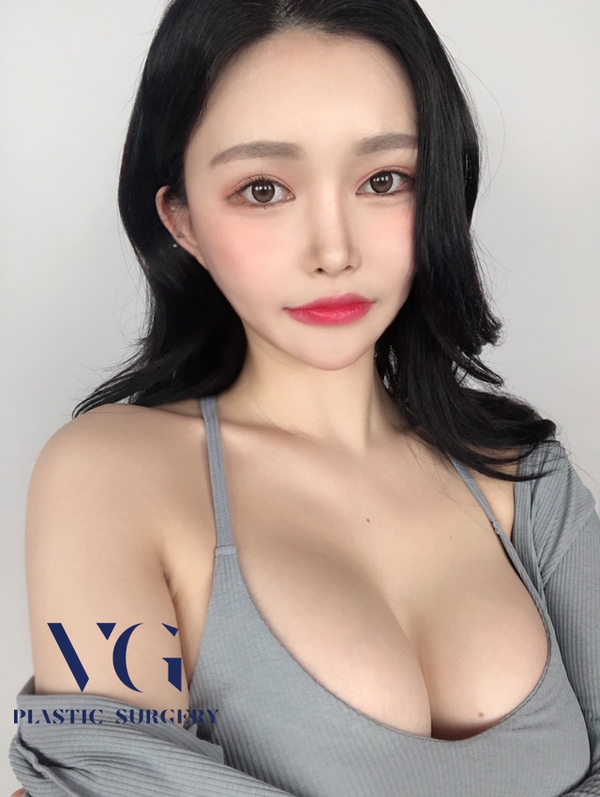 가슴성형잘하는병원 자신감넘치는 가슴볼륨 관련 이미지 1