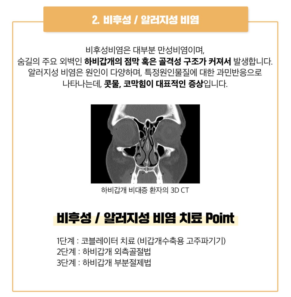 비염코성형 원인 파악부터 비용까지 관련 이미지 6