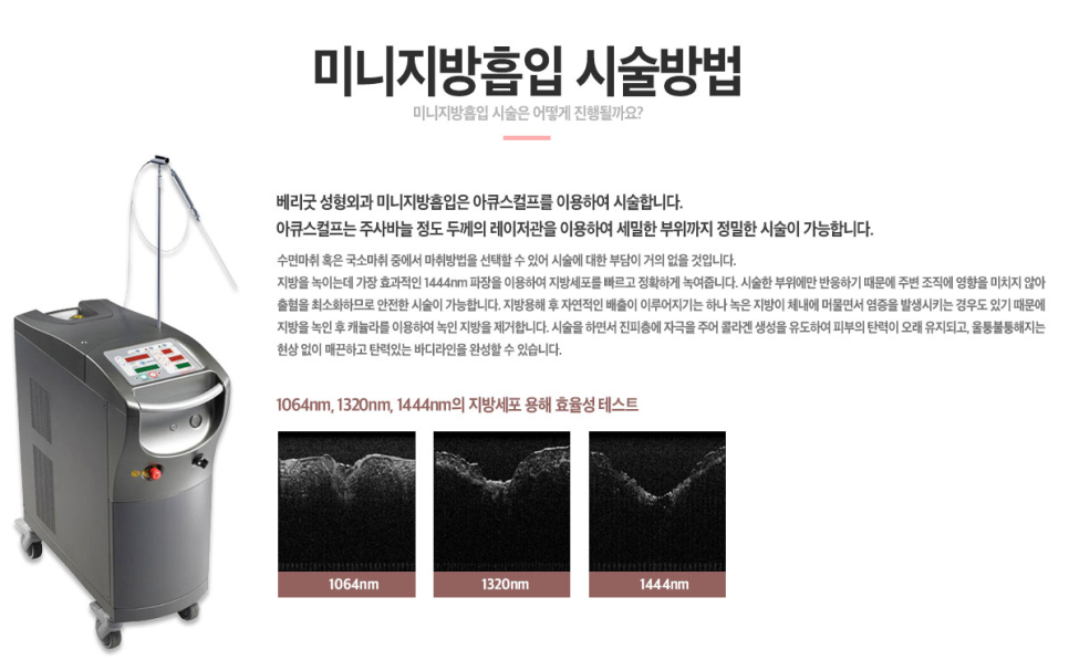 내가 뽑고 싶은 부위만💛미니지방흡입 관련 이미지 4