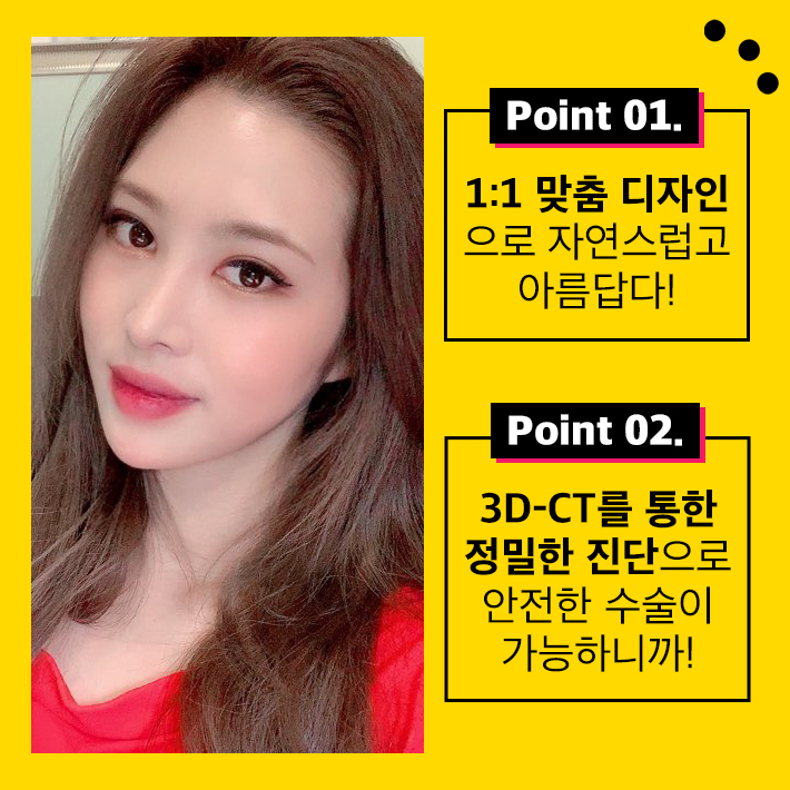 오똑하고 세련된 코라인 이젠 필러말고 코성형으로 확실하게! 관련 이미지 3