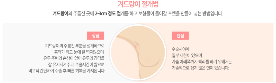 베리굿성형외과 보여줄게, 가진 자의 여유! 프리미엄 가슴확대술 관련 이미지 5