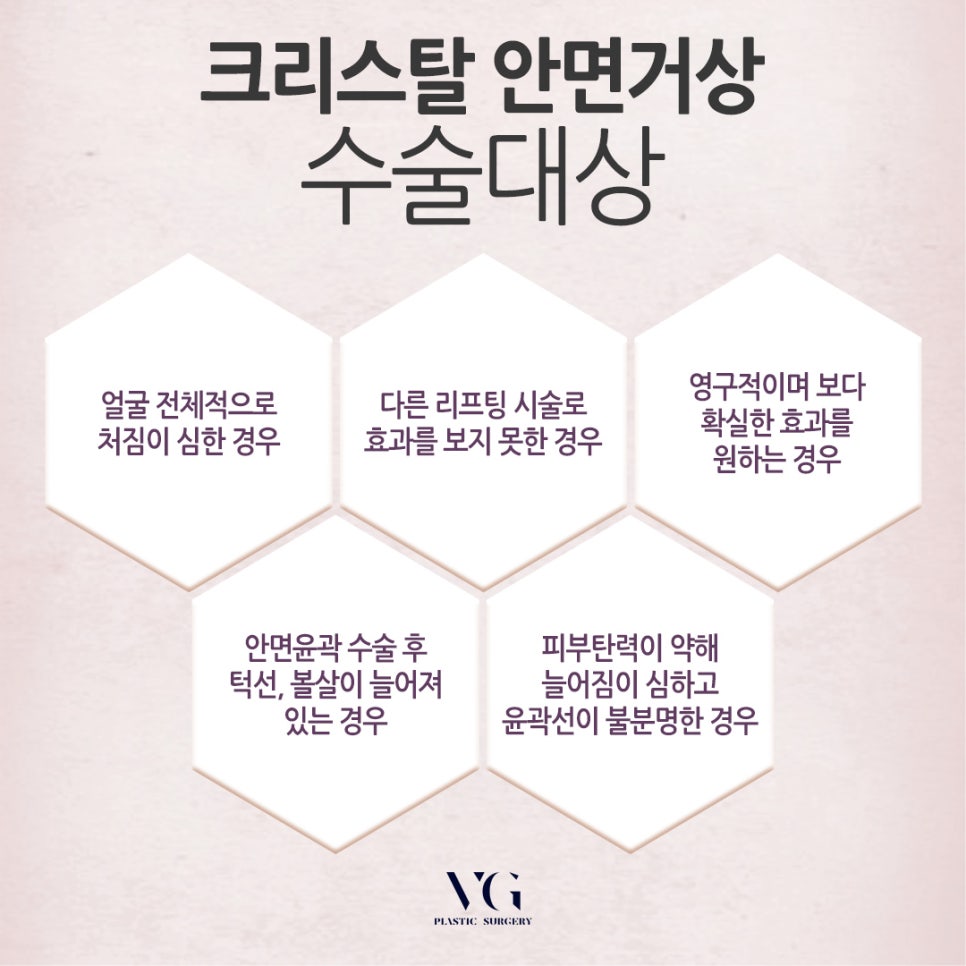 안면거상 가격 / 안면거상 후기 관련 이미지 2